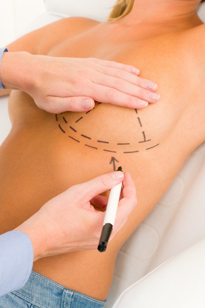 Breast Lift Consultation